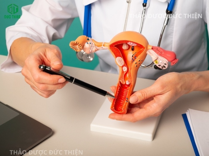 Bác sĩ tư vấn lộ trình hỗ trợ điều trị viêm lộ tuyến và u xơ bằng thảo dược tự nhiên