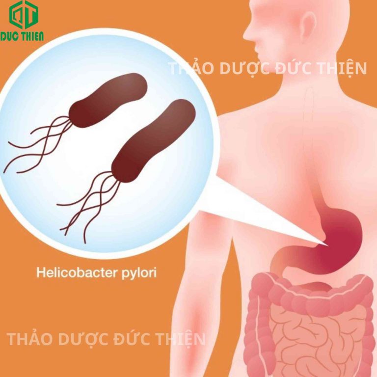 Hình ảnh mô phỏng vi khuẩn HP (Helicobacter pylori) trong dạ dày - nguyên nhân gây viêm loét và ung thư