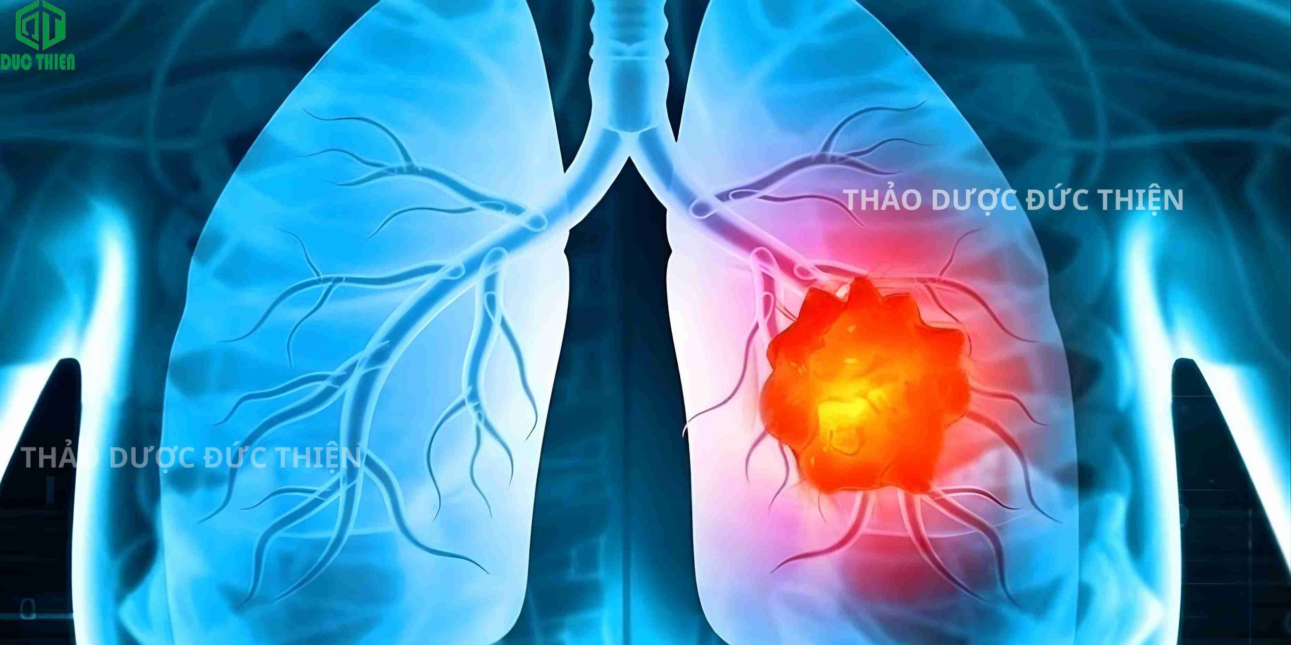 Xạ đen giúp trị ung bướu trong cơ thể