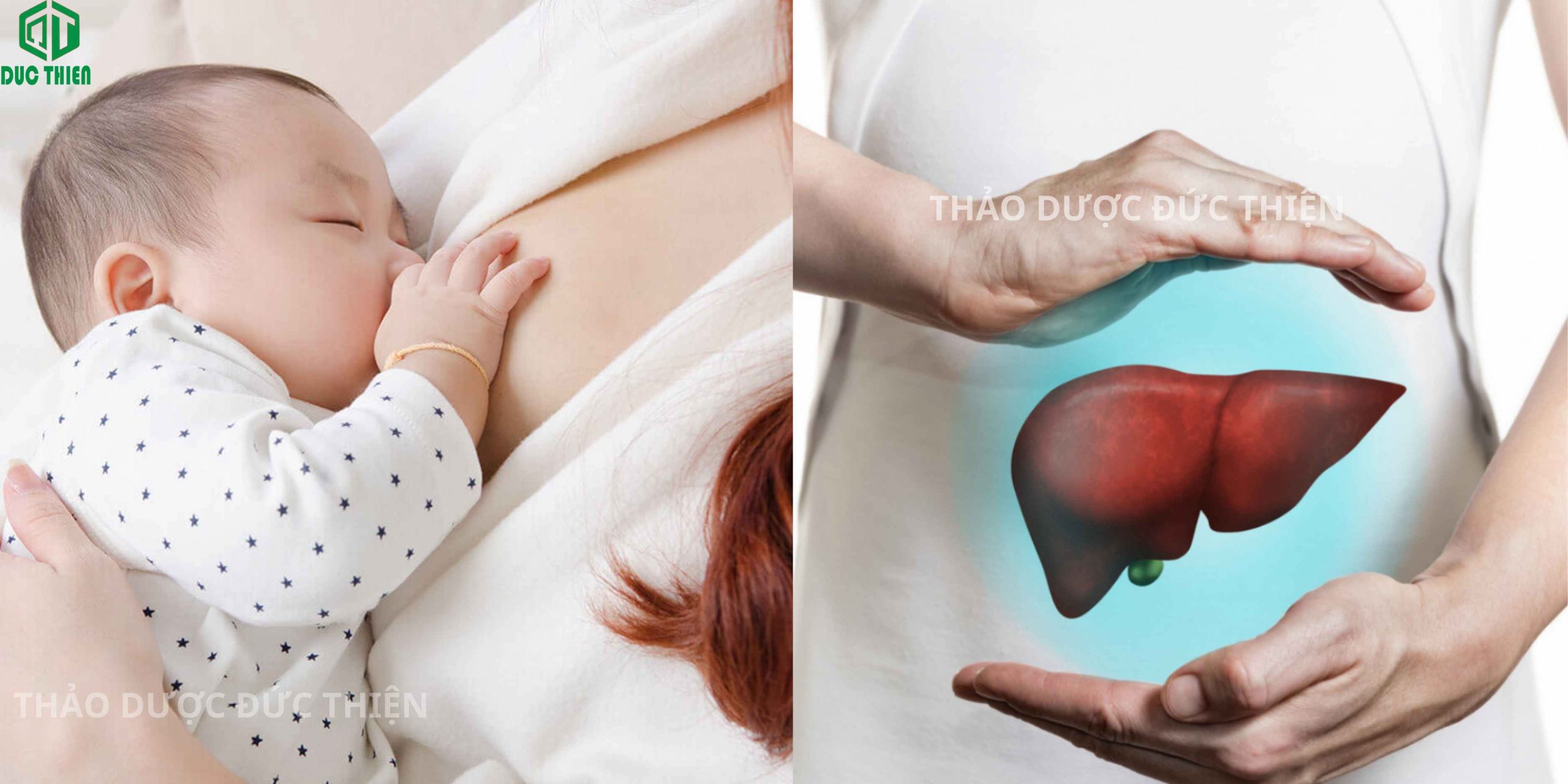 Bồ công anh hỗ trợ lợi sữa mát gan cho mẹ bỉm