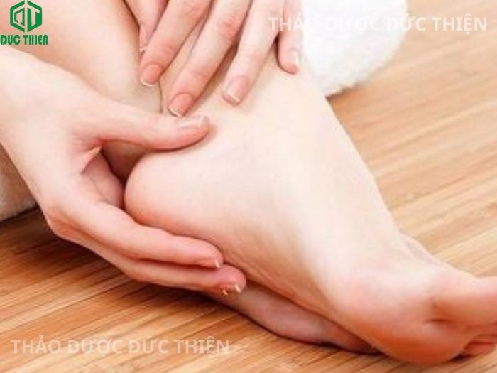 cây quýt gai trị thoái hóa khớp, phù thũng