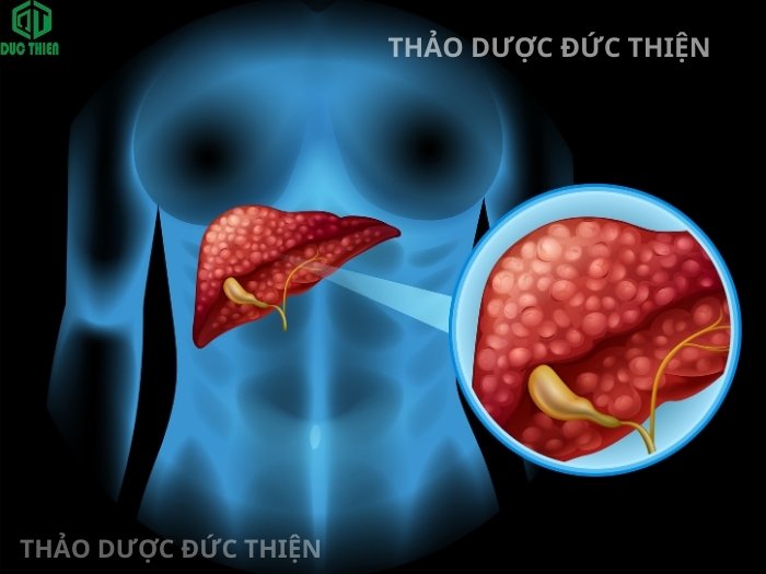 Cơ chế tác động của lá sen giúp giảm mỡ gan và bảo vệ tế bào gan nhiễm mỡ