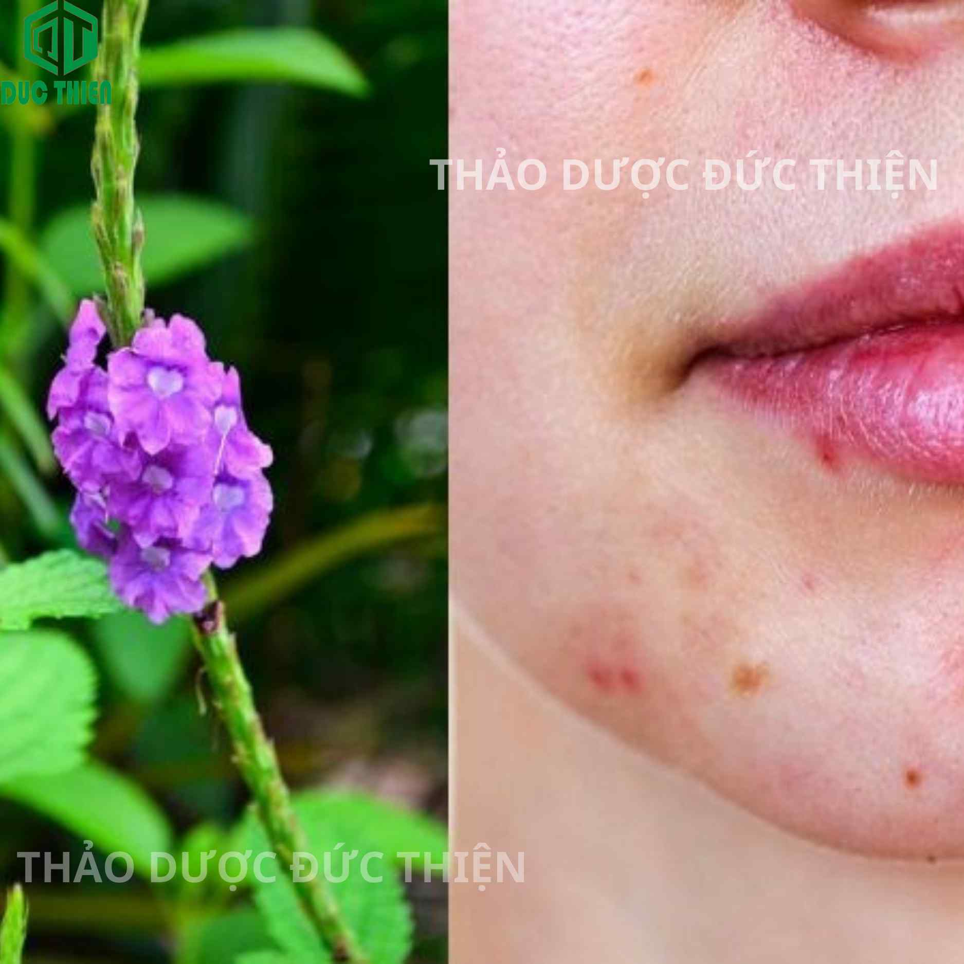 Cây đuôi chuột hỗ trợ thanh nhiệt trị nóng trong