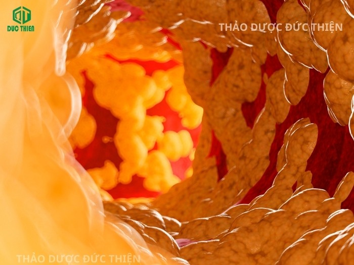 Tác dụng của kỷ tử đỏ giúp giảm mỡ máu và cholesterol xấu bảo vệ tim mạch